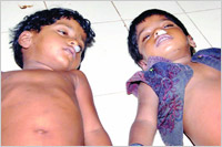 Karkala: 2 kids drown in a percolation pond